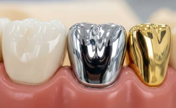Dental Crown Cost in Kenya 2026