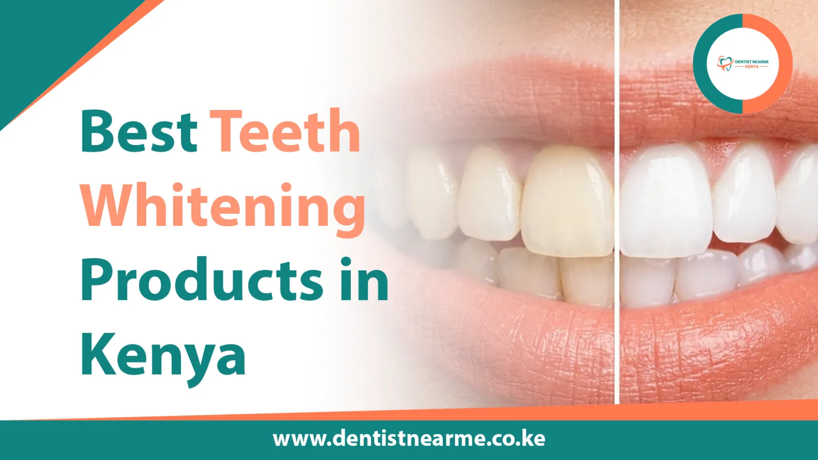 Best Teeth Whitening Products in Kenya